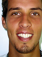 Alexandre Simoni